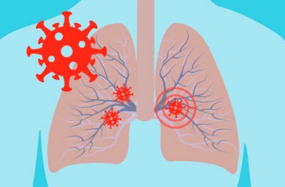 Respiratory Disease(lungs)