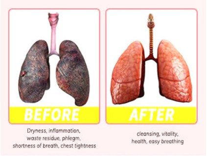 before and after for damage lungs