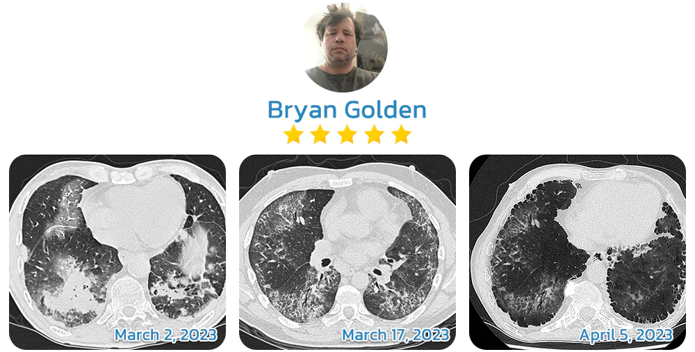 customer review for lungs cleaning device 2