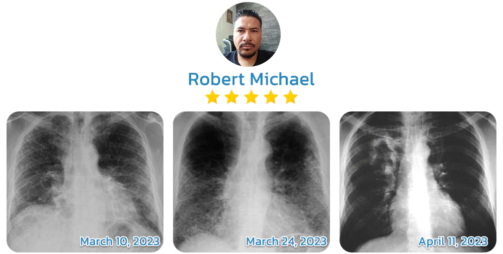 customer review for lungs cleaning device