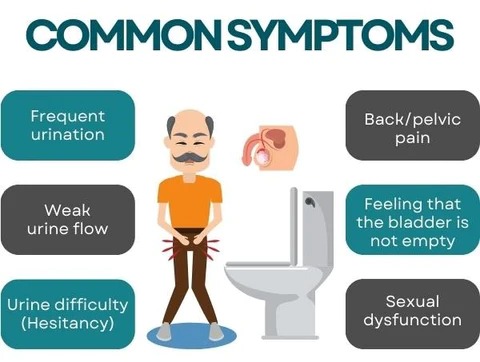 common symptoms on PROSTATE CARE POINT CLIP